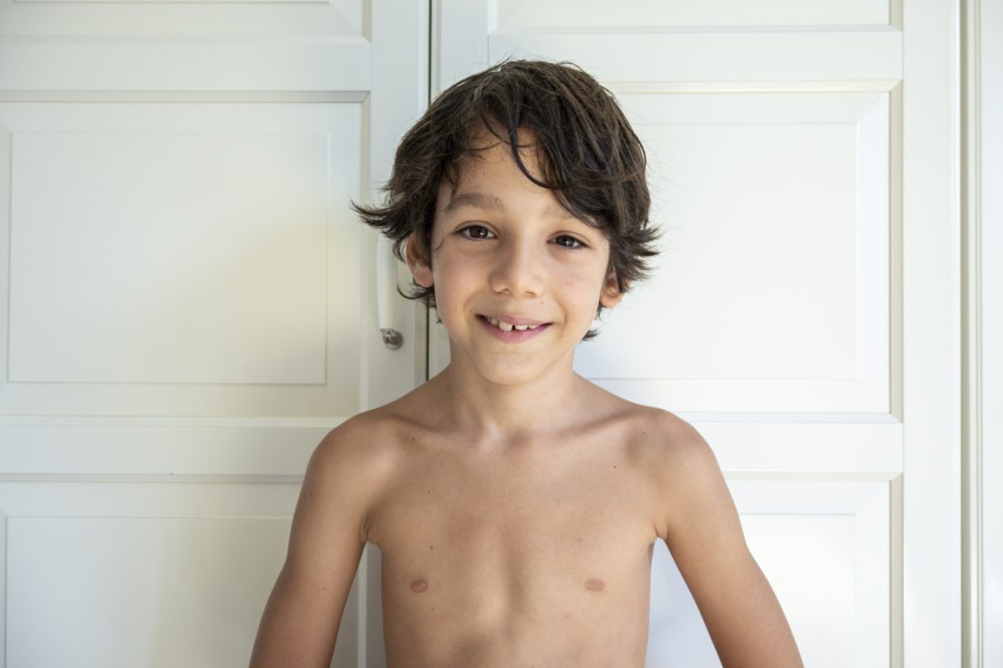 How to Treat Icky Impetigo