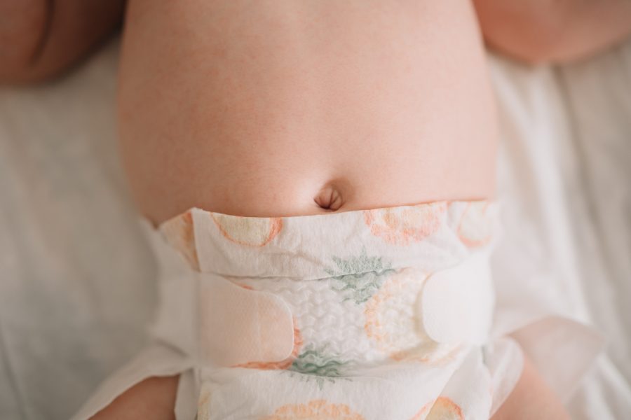 Newborn umbilical cord care: learn what’s normal, how to care for it, and when bleeding, infection, or other concerns need medical attention.
